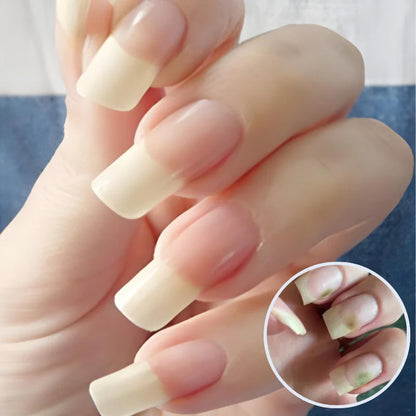 GEL TRATAMIENTO ANTIFÚNGICO