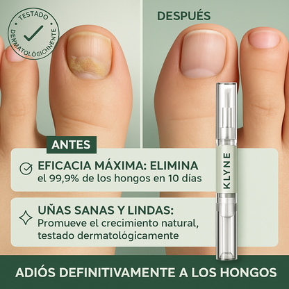 Sérum Antifúngico Elimina hongos